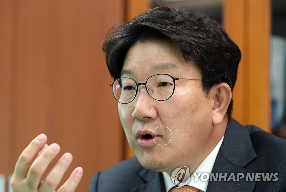 권성동 국민의힘 원내대표의 입가에 있는 점은 구설의 뿌리다. 이 점을 빼면 구설이 현저히 줄어들고 오해도 덜 받는다. / 연합뉴스