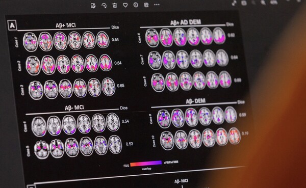 스위스 제네바에 있는 대학병원(HUG) 노인병학과 기억센터에서 알츠하이머병을 앓는 환자의 자료가 보여지고 있다. /로이터 연합뉴스