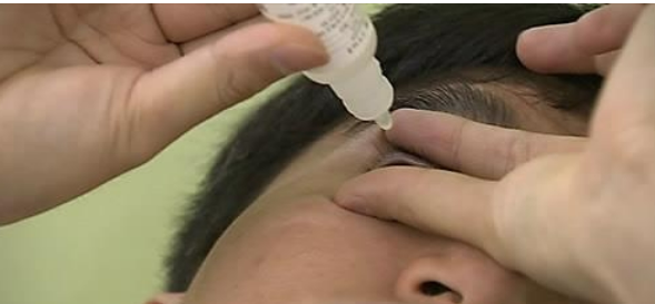 인공눈물을 사용하는 사람의 모습이다. /연합뉴스