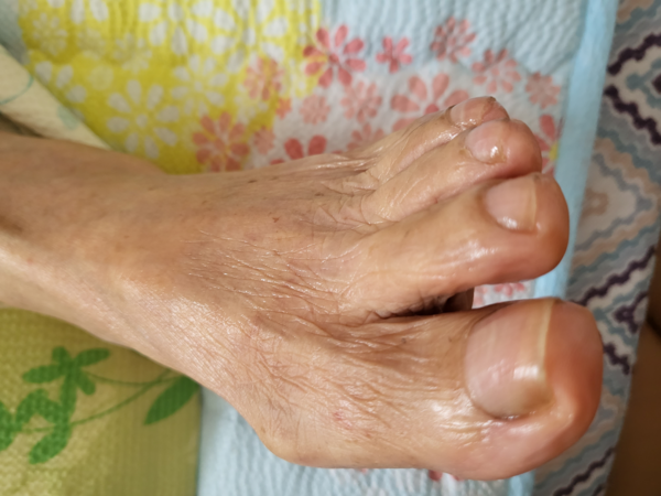 낮잠 주무시는 동안에 물티슈로 목욕을 해도 지워지지 않던 손발 찌든 때를 깨끗이 닦아내고 큐티클 오일을 발라 드리면서 내 발보다 깨끗함에 흐뭇해졌다. /김희정