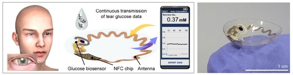 스마트 콘택트렌즈 모식도 및 이미지 /세브란스병원