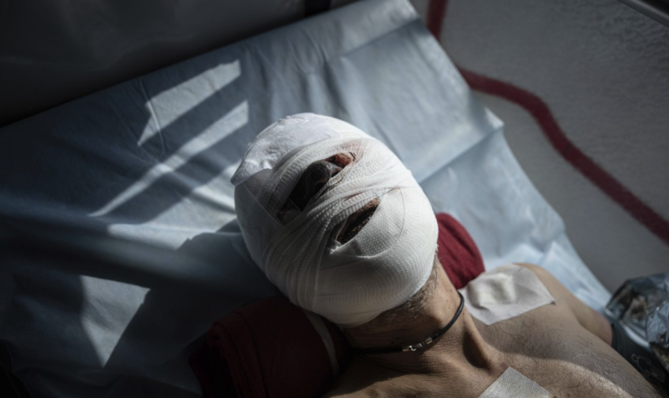 지난해 3월 22일(현지시간) 우크라이나 동부 도네츠크주에서 부상한 우크라이나 군인이 병상에 누워 있다. /AP=연합뉴스