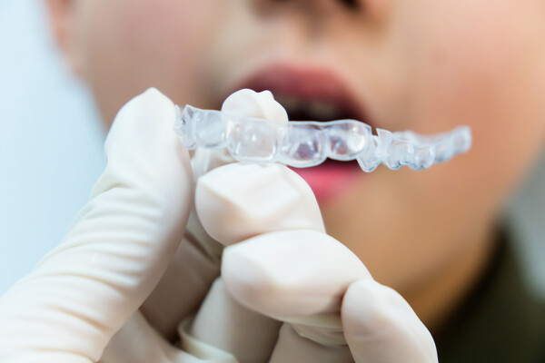 치아 교정 치료를 받을 때는 치과에 가기 전 미리 집에서 궁금한 내용을 충분히 생각하고 가족 간에 상의해서 정리한 후에 그 내용을 병원에서 질문하고 답변을 받으면서 설명을 듣는 것이 중요하다. /게티이미지뱅크