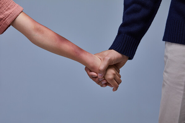 장애아동을 학대하는 가해자 중 절반 이상이 가족이나 친인척으로 밝혀졌지만 이들을 보호할 쉼터는 전국에 10곳에 불과해 심각한 문제가 제기되고 있다. /게티이미지뱅크