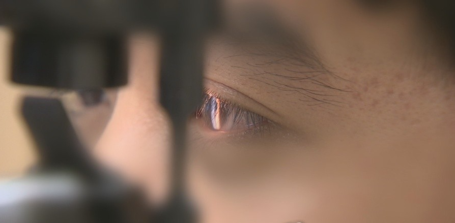 2016년 실손보험 표준약관이 개정됨에 따라 백내장 수술 시 수정체 혼탁 부분을 제거한 후 다초점 인공수정체(렌즈)를 삽입하는 과정 중 발생하는 렌즈 가격은 보장 대상에서 제외됐다. /연합뉴스