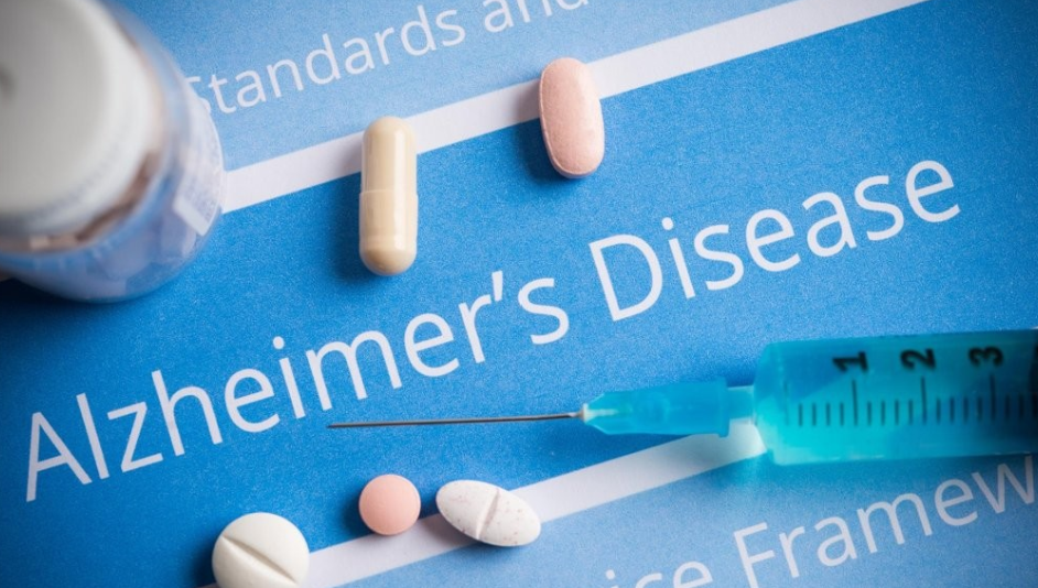 알츠하이머 신약 /게티이미지뱅크
