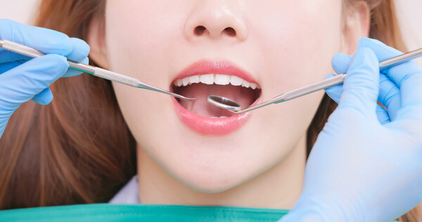 최근 과학기술의 발전으로 치과 치료 재료에도 신소재들이 계속 개발되고 있어 선택의 폭이 넓어지고 있다. 그러나 환자 스스로 각 재료의 특징을 알고 장단점을 비교해 보며, 자신의 상황에 맞는 선택을 할 수 있도록 준비되어야 한다. /게티이미지뱅크