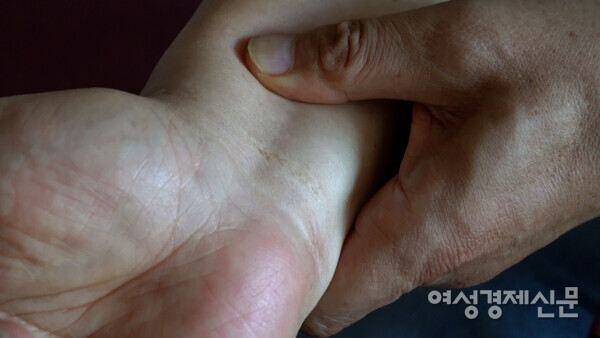 장 목사는 중국에서 선교하다가 5년간 수감 생활을 했다. 그의 손목에는 수갑 자국이 남아있다. /장세곤 기자