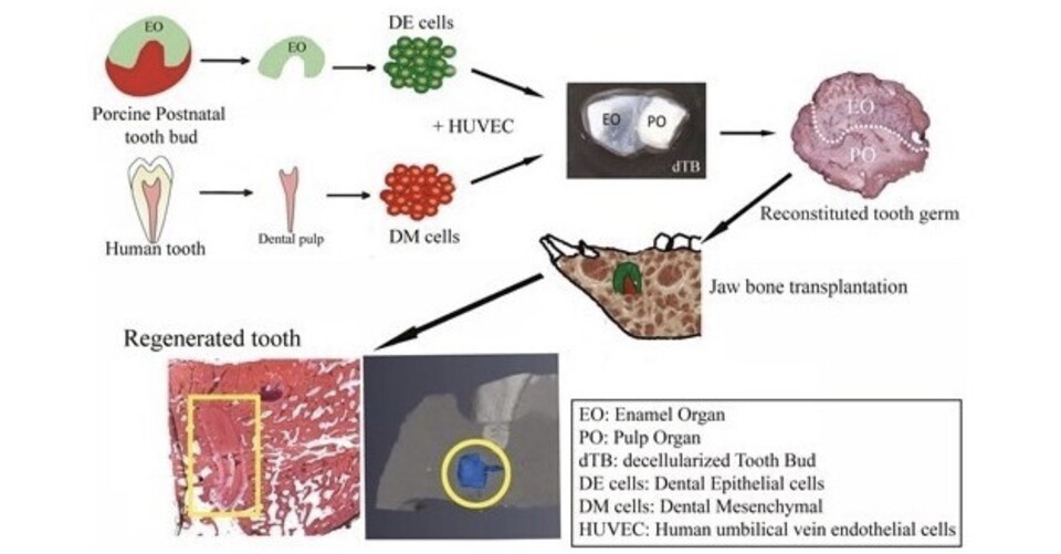 임플란트의 단점인 치근막 부재와 골흡수 문제를 보완할 수 있는 ‘살아있는 치아’가 개발됐다. 美 연구진은 사람과 돼지 세포를 조합해 생체 치아를 만들어 동물실험에서 60% 이상 성공률을 기록했다. /미국 터프츠대학교