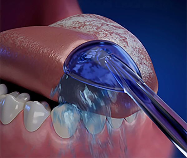 혀 클리너는 혀 뒤쪽부터 앞쪽까지 부드럽게 긁어내듯 사용한다. /픽사베이