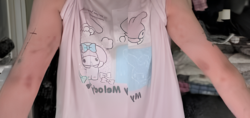 지난 14일 오전 서울 홍대 인근에서 대만인 유튜버 A씨와 동행인 한 명이 한국인 남성으로부터 폭행당한 사건이 해외 언론에 보도됐다. 사진은 인스타그램에 올라온 A씨의 사진이다. /인스타그램