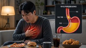 제일약품 '자큐보' 처방액 200억 돌파···위식도역류질환, 환자 얼마나... - 뉴스 썸네일 이미지